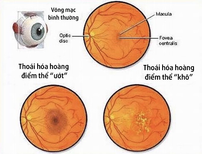 chụp đáy mắt